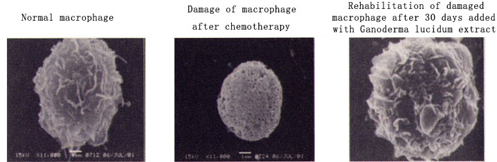 Ganoderma macrophage rehabilitation