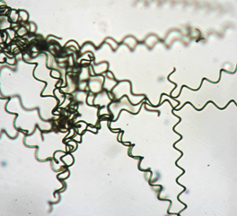 Spiral structure of Spirulina platensis under the microscope.